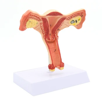 Ženski Maternico Jajčnikov Model Ženskih Spolnih Anatomija Model Medicinski Model Poučevanja